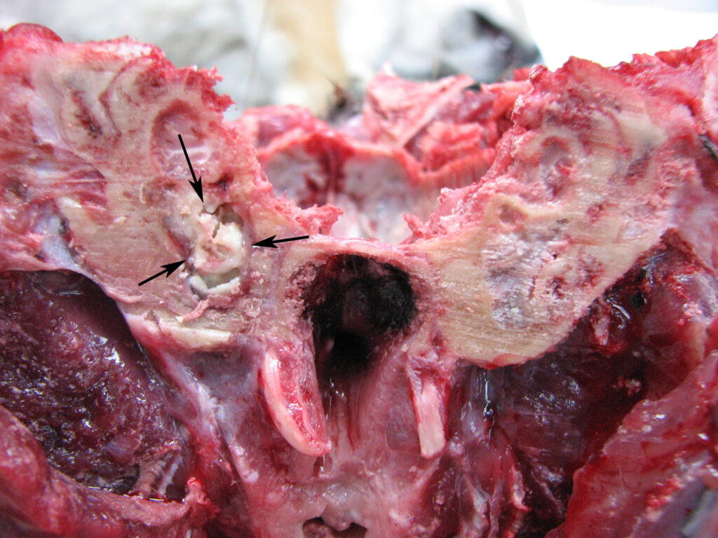 Bever met middenoorontsteking