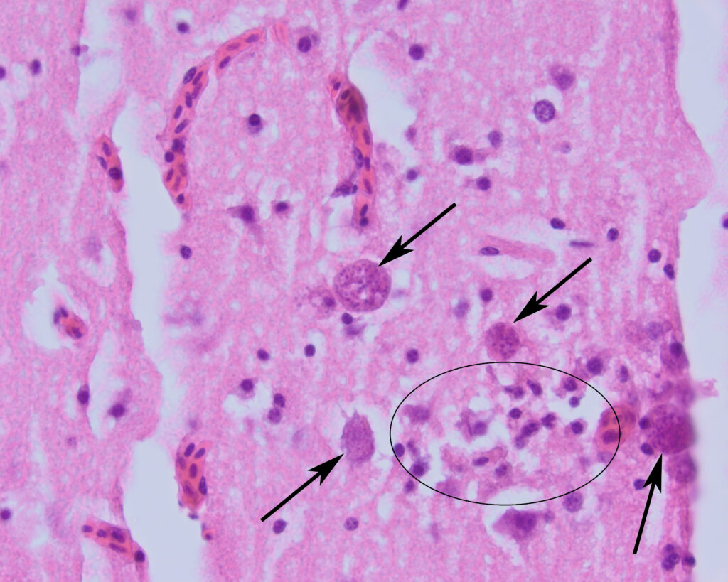 Microscopisch beeld van hersenweefsel van de groene specht met T. gondii cysten (pijlen) en ontstekingsreactie (omcirkeld).